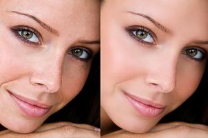 Retouch skin in Photo