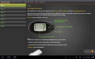 Dexcom