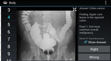 Radiology Flashcards: Free