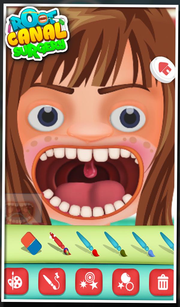 Root Canal Surgery