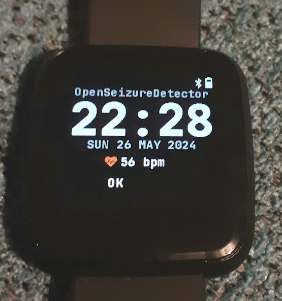 OpenSeizureDetector