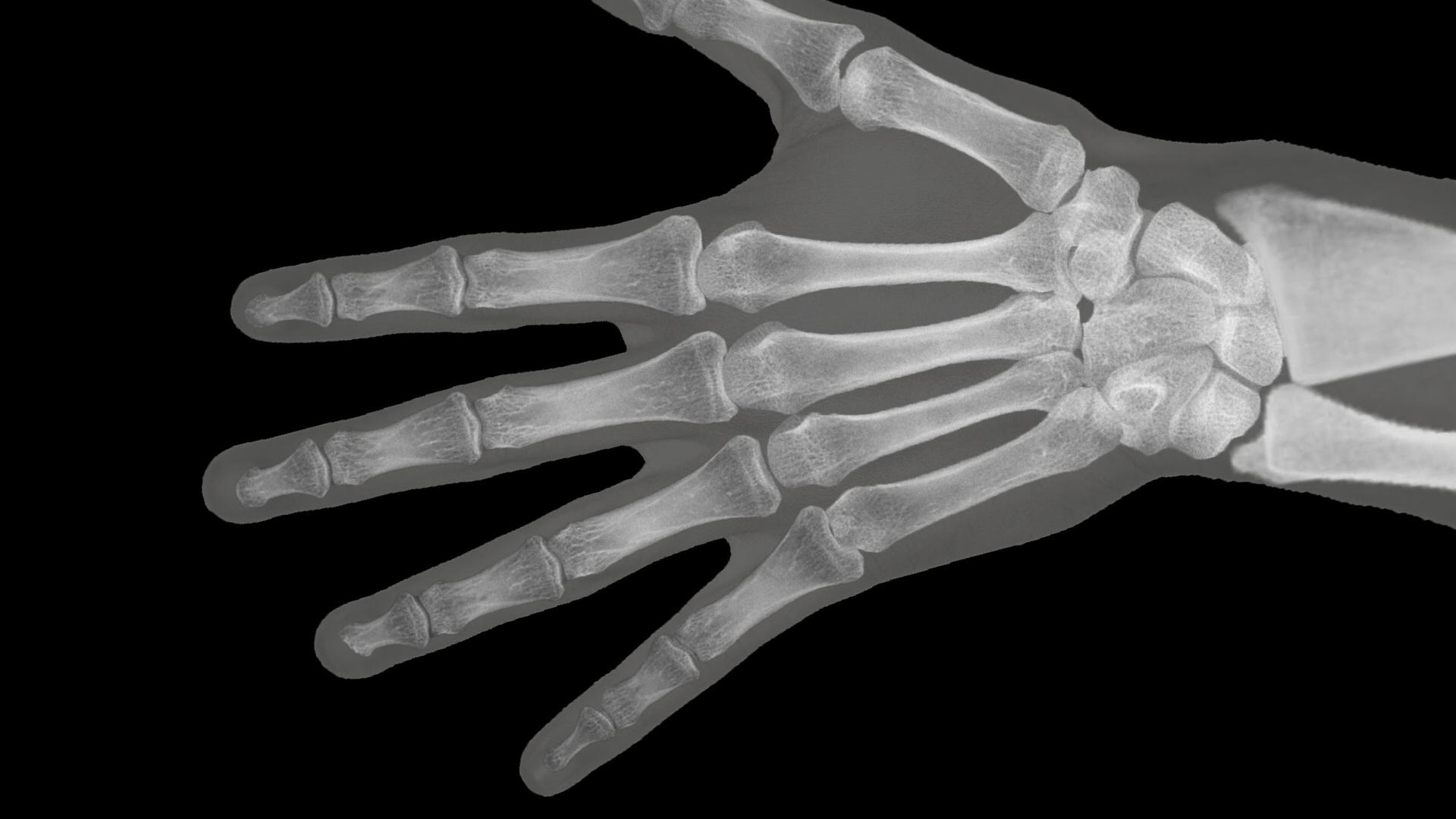 Ultimate X-Ray Scanner