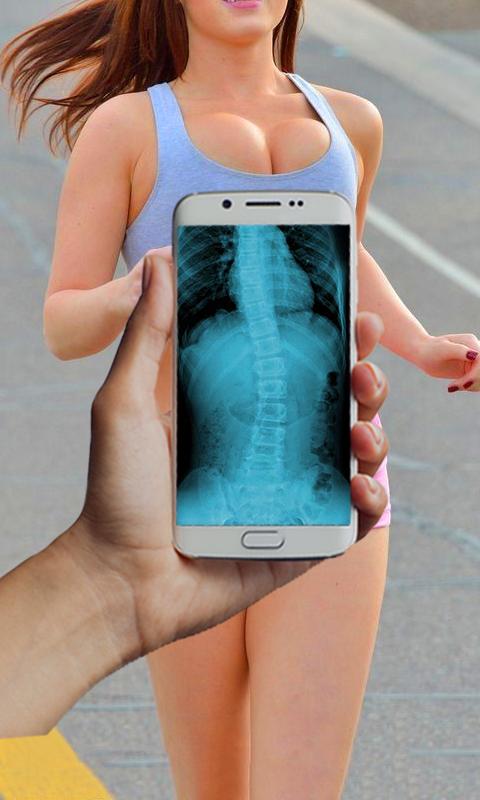 Blonde Xray Scanner Prank